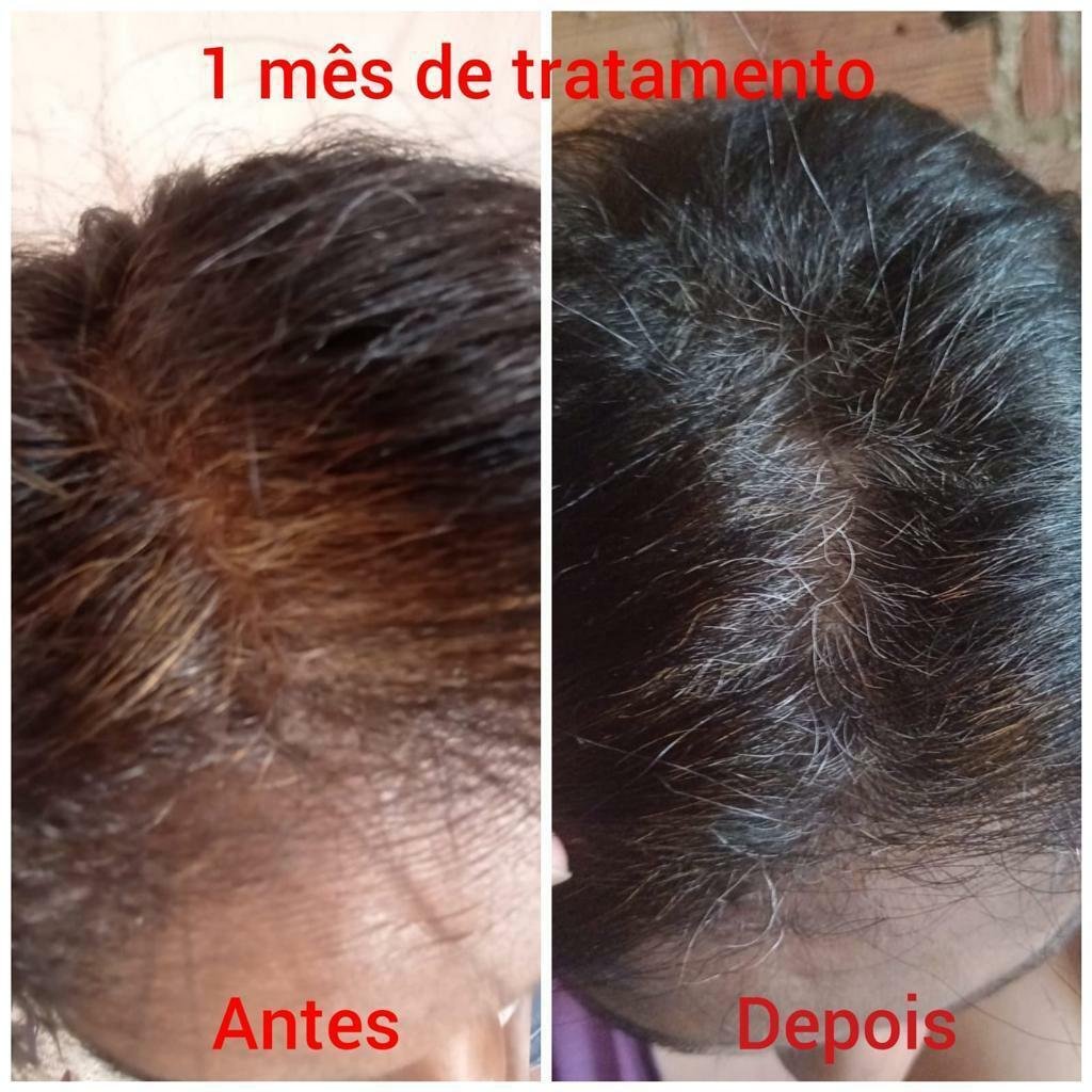 Crescimento capilar após 30 dias de uso do Long Beauty