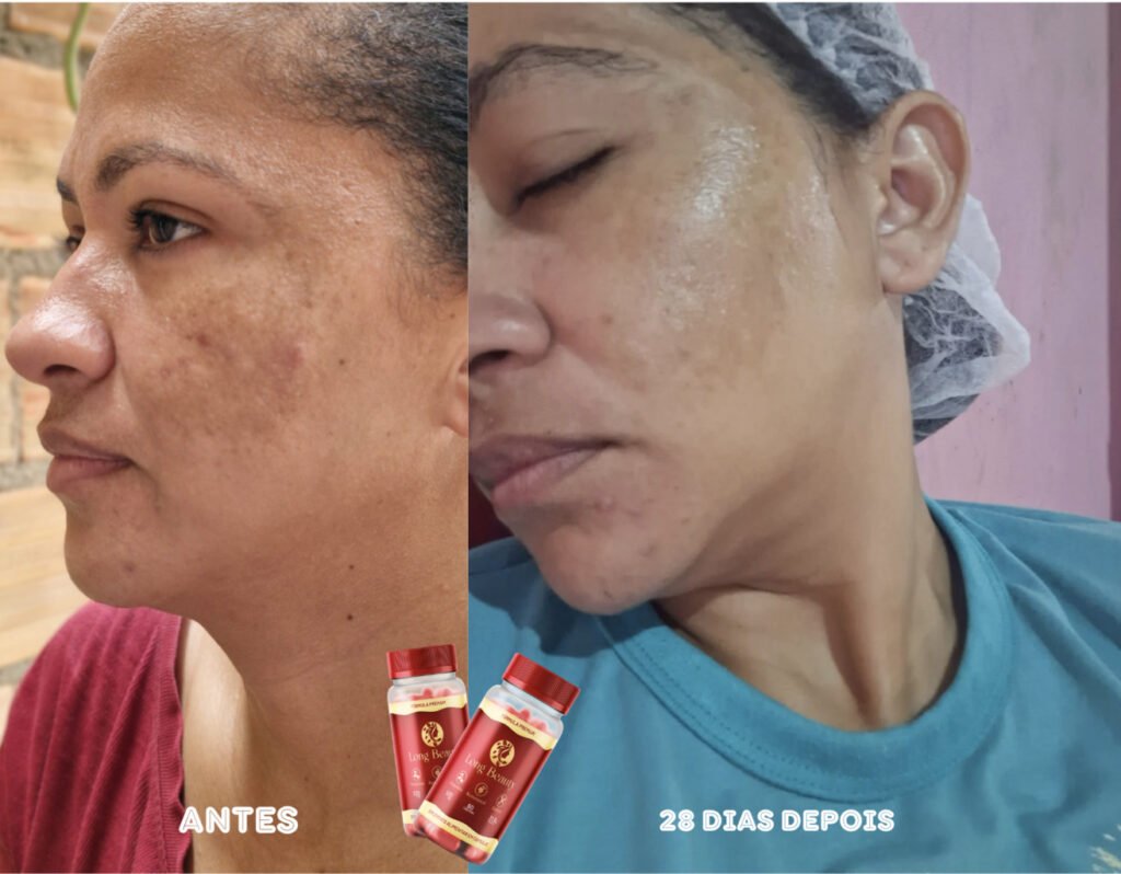 Pele radiante e saudável com o uso de Long Beauty